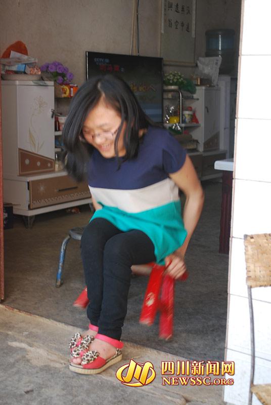 女孩患脆骨病曾骨折30多次 以板凳代步(圖)