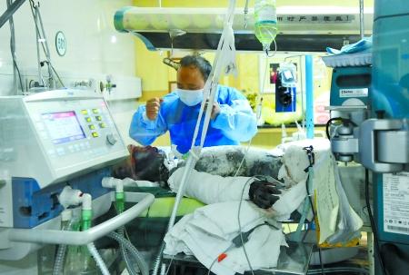 11歲女孩掉進(jìn)沸騰大鍋燙傷 母親割皮救女兒(圖)