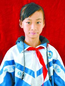 11歲女孩掉進(jìn)沸騰大鍋燙傷 母親割皮救女兒(圖)