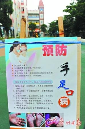 四歲男童染手足口病死亡 專家:目前正處發(fā)病高峰期