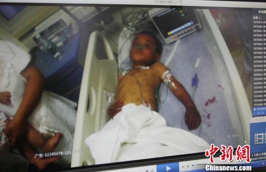 河北6歲男童遭繼母施暴 雙手被吊長達3小時