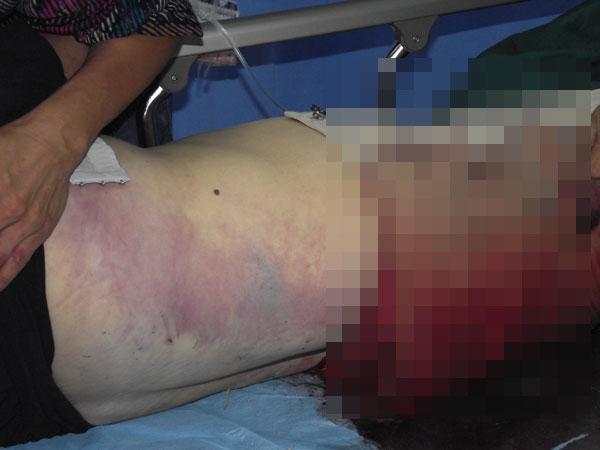 福州女子被山東鐵警跨省調(diào)查后死亡 身上有淤青