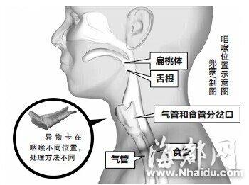 九歲男童吃牛排骨頭卡喉 延誤搶救時機身亡(圖)