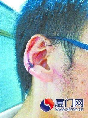 男子學(xué)車被教練揪破耳朵：買兩包中華煙來