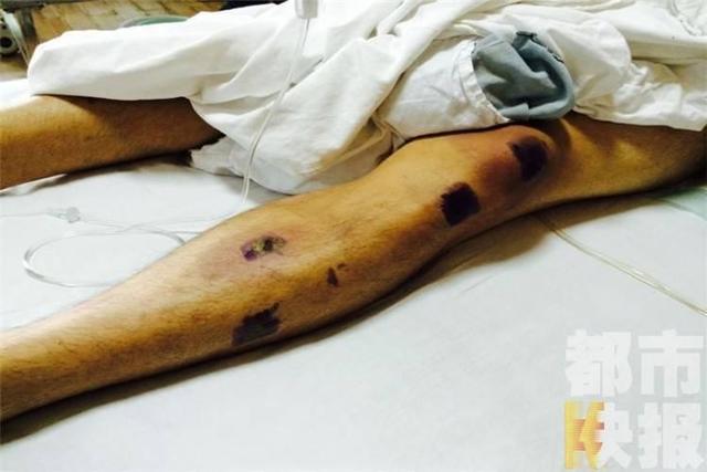 陜西高校老師偷拍女生洗澡 被打成重傷生命垂危