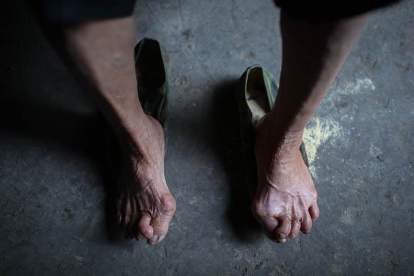 廣西村莊被重金屬污染 村民體檢報告封存9年