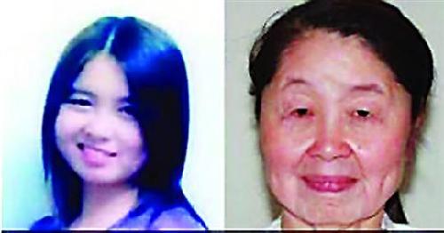 28歲女子患罕見皮膚松弛怪病 “一夜”變老嫗