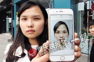 女子萬元割雙眼皮被整成高低眉 院長(zhǎng)稱效果挺好