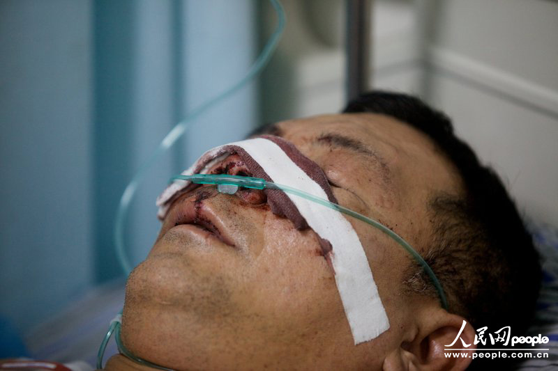 12月30日，深圳龍崗區(qū)六約社區(qū)麻地村民陳錦華在埔廈路一柜員機(jī)取完錢之后被三名刀手圍砍身中十多刀，取的錢散落一地刀手卻分文未取。此前他曾經(jīng)實(shí)名舉報過村官。王子榮/CFP