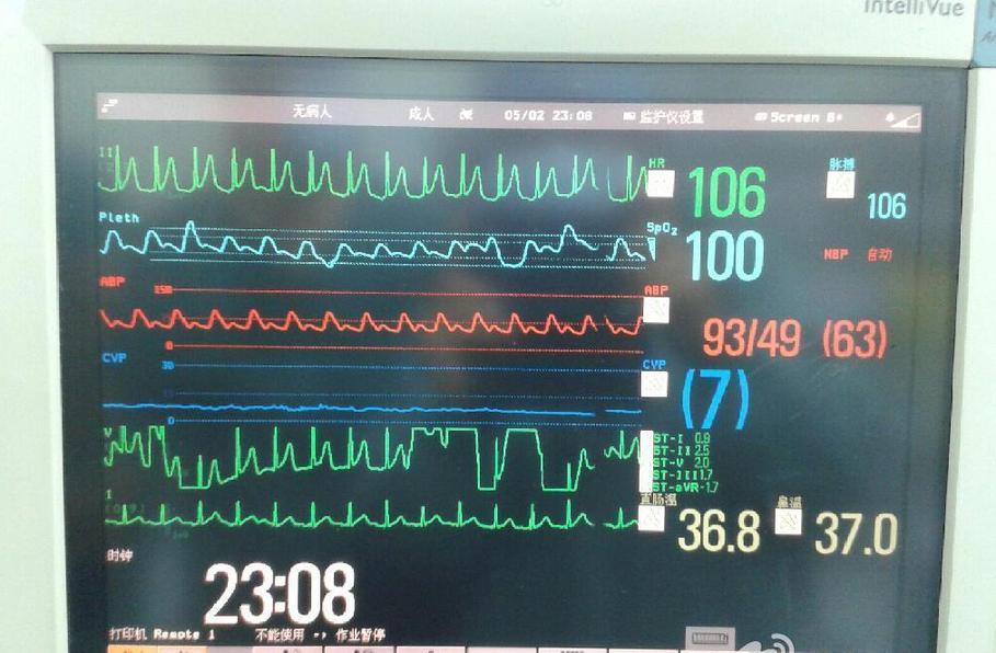 一顆健康的心臟開始了有力跳動(dòng)