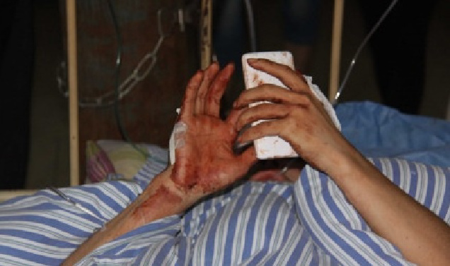 宜春遇砍人奪刀救人少年無(wú)緣高考