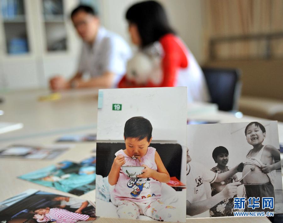 （社會）（3）中國首例兒童肝移植患者已健康生存14年