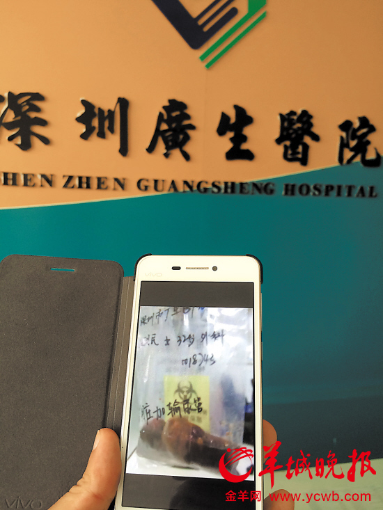 　　衛(wèi)間民被切掉的左腎